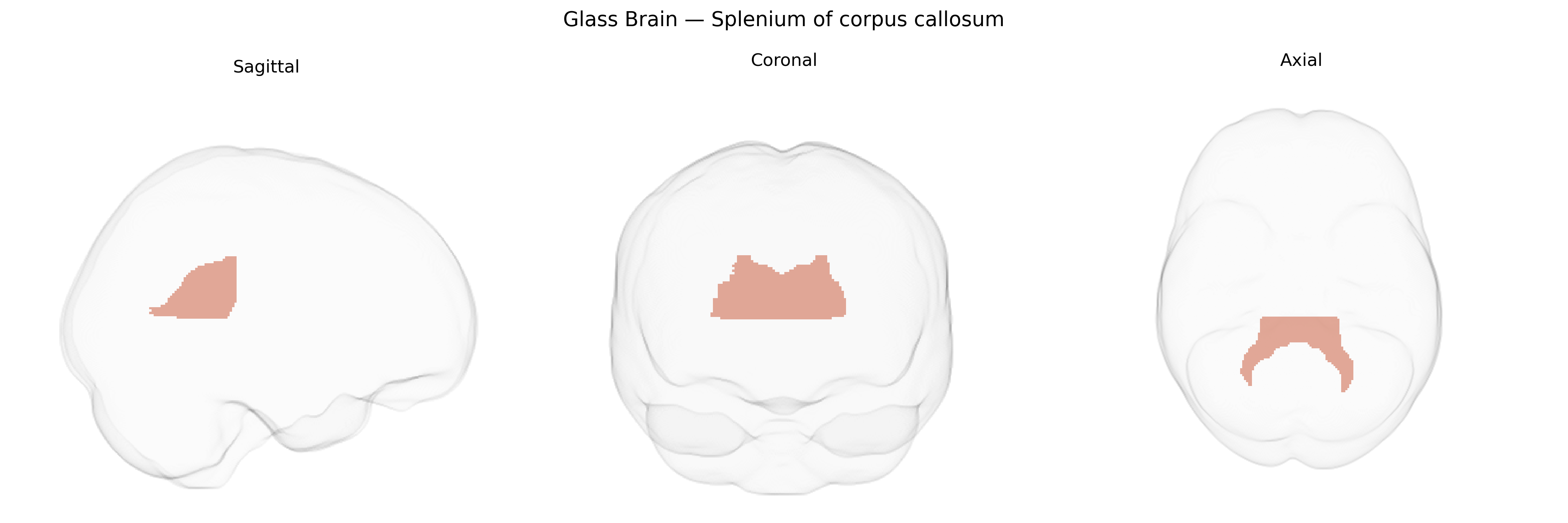 Triplanar Ghost Brain