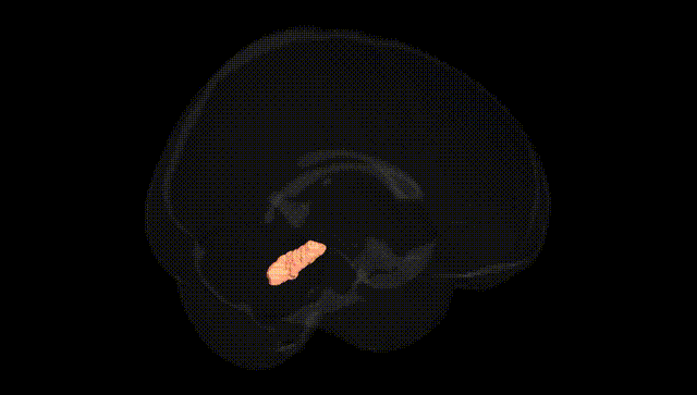 Full Brain Black