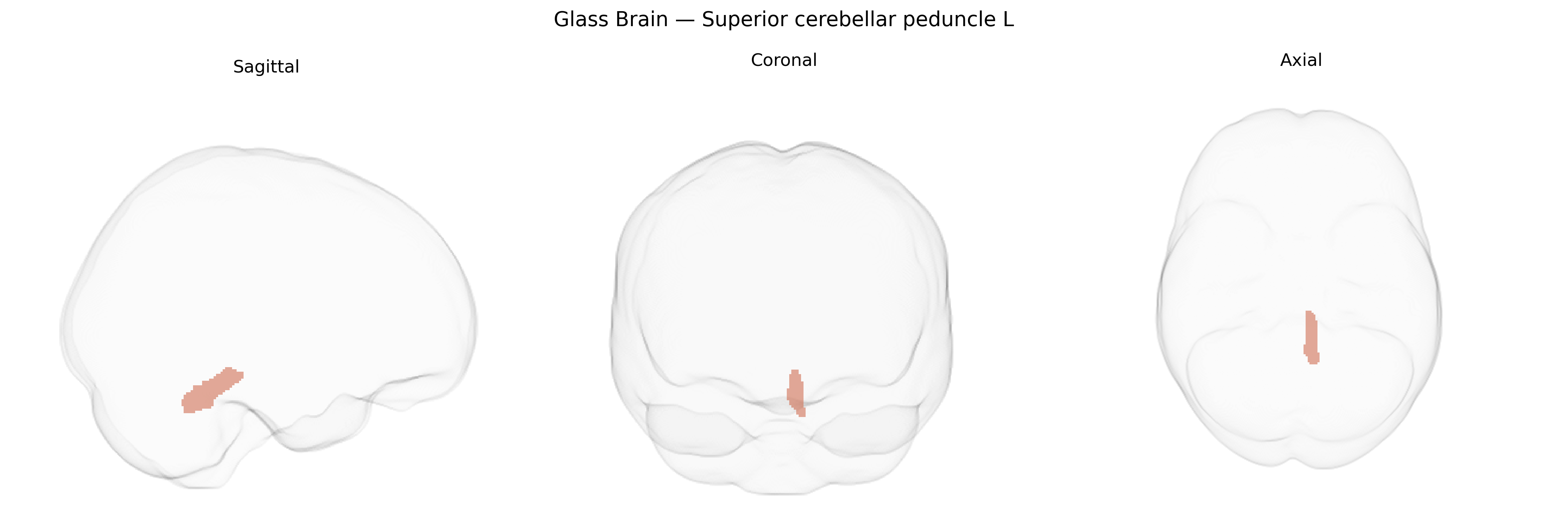 Triplanar Ghost Brain