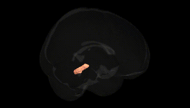 Full Brain Black