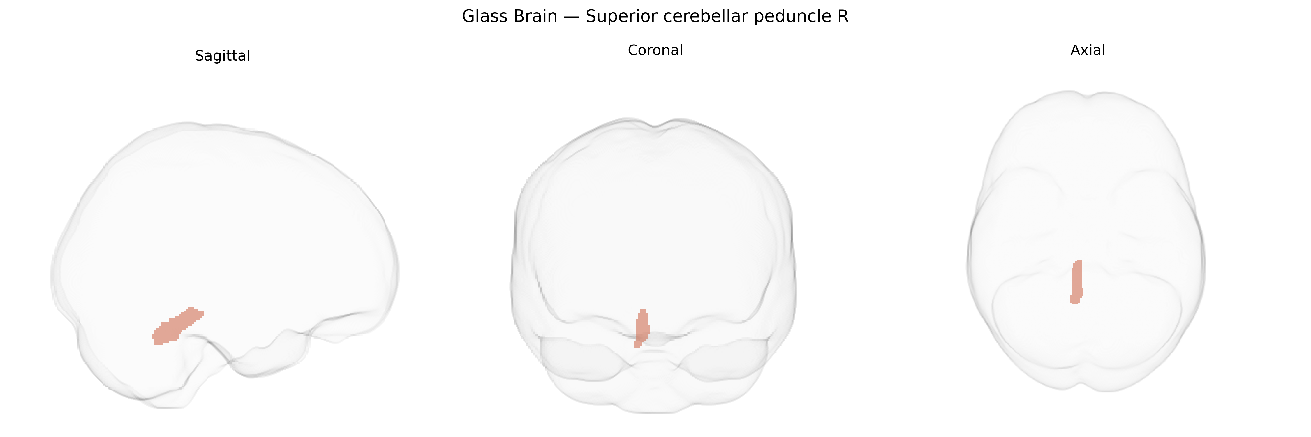 Triplanar Ghost Brain