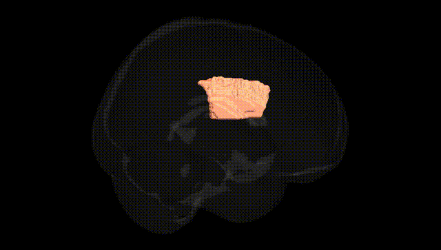 Full Brain Black