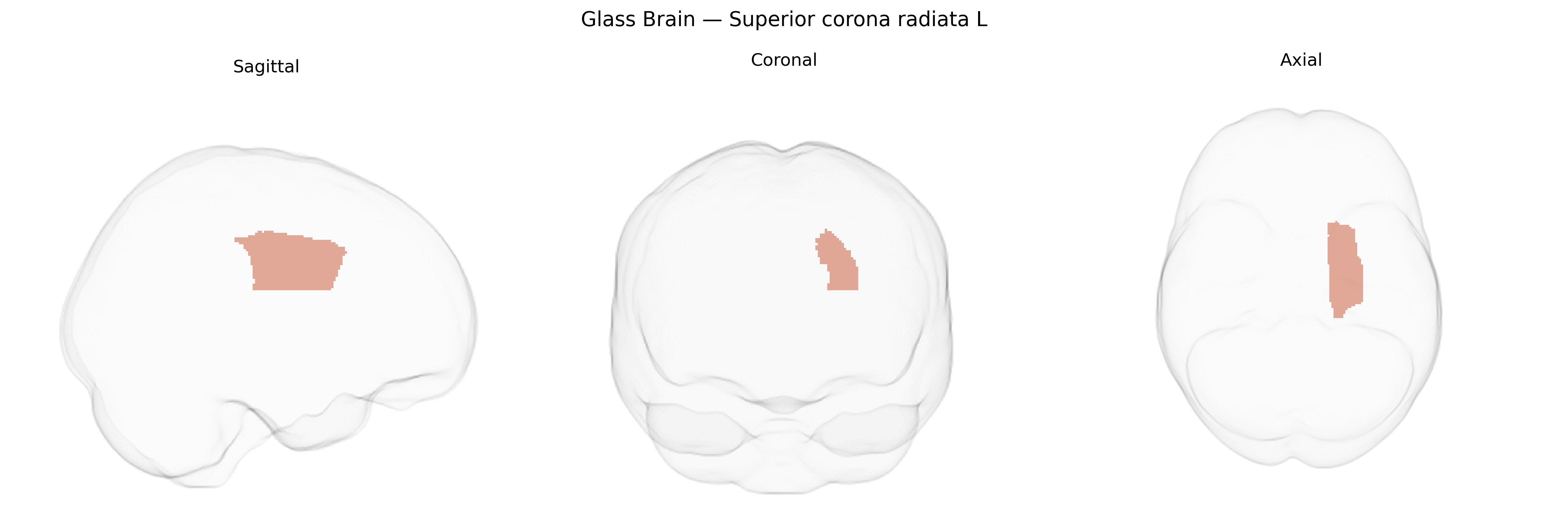 Triplanar Ghost Brain