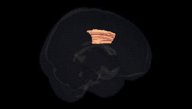 Full Brain Black