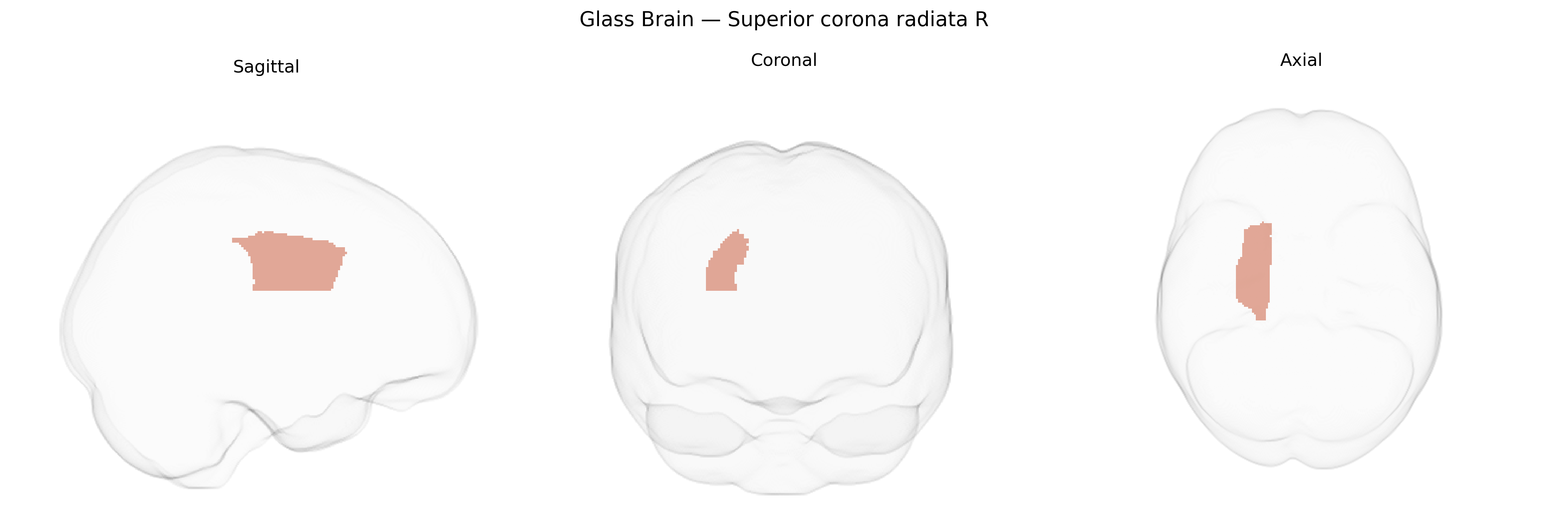 Triplanar Ghost Brain