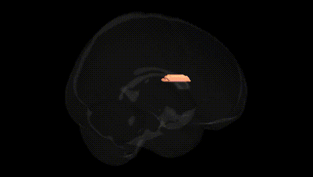 Full Brain Black