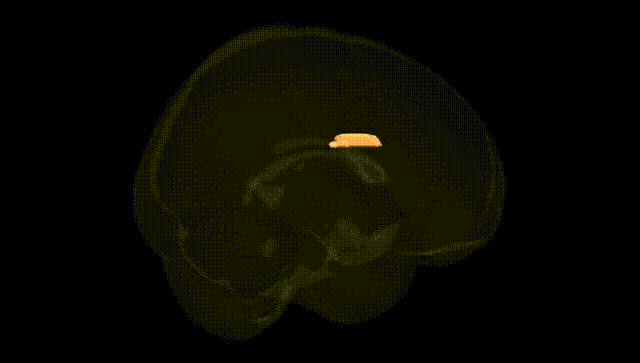 Full Brain Black