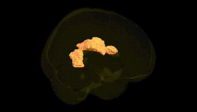 Full Brain Black
