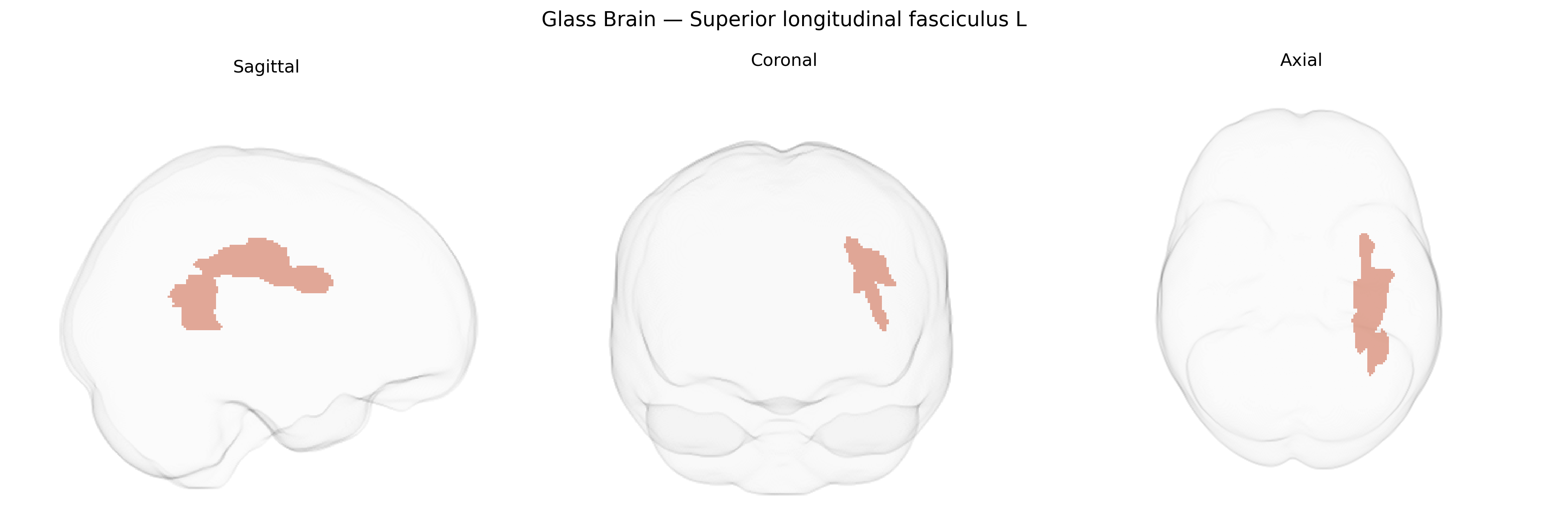 Triplanar Ghost Brain