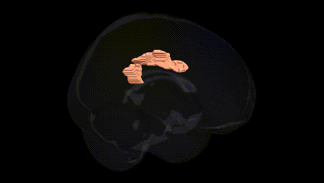 Full Brain Black