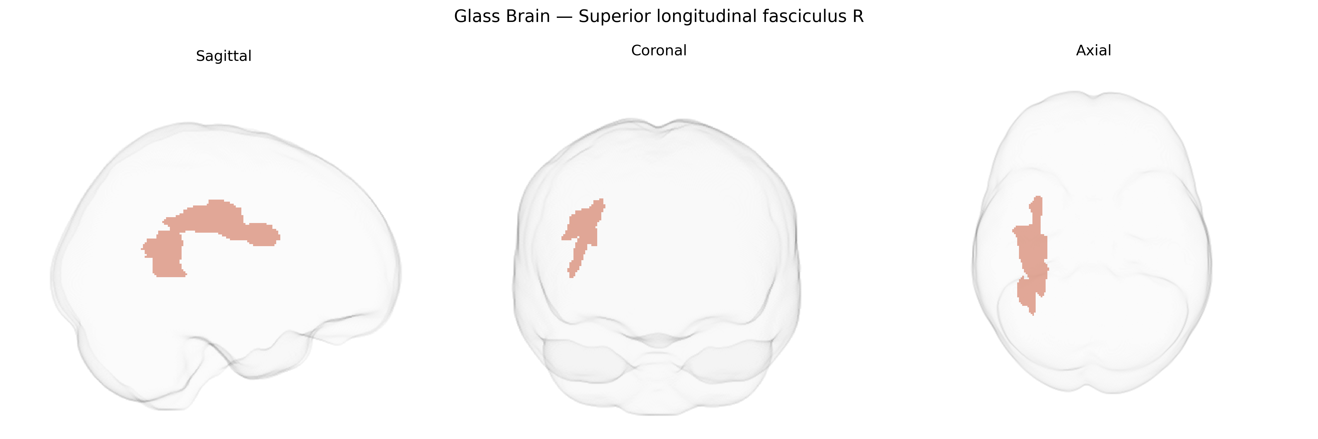Triplanar Ghost Brain
