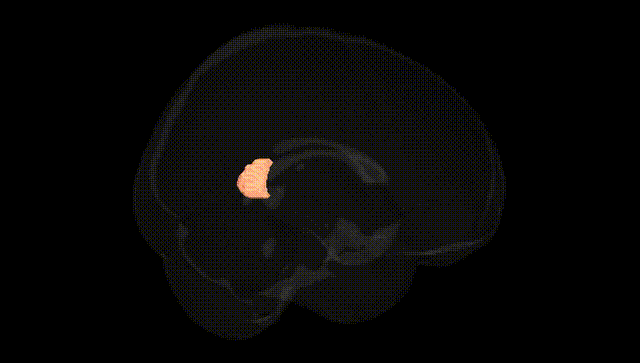 Full Brain Black