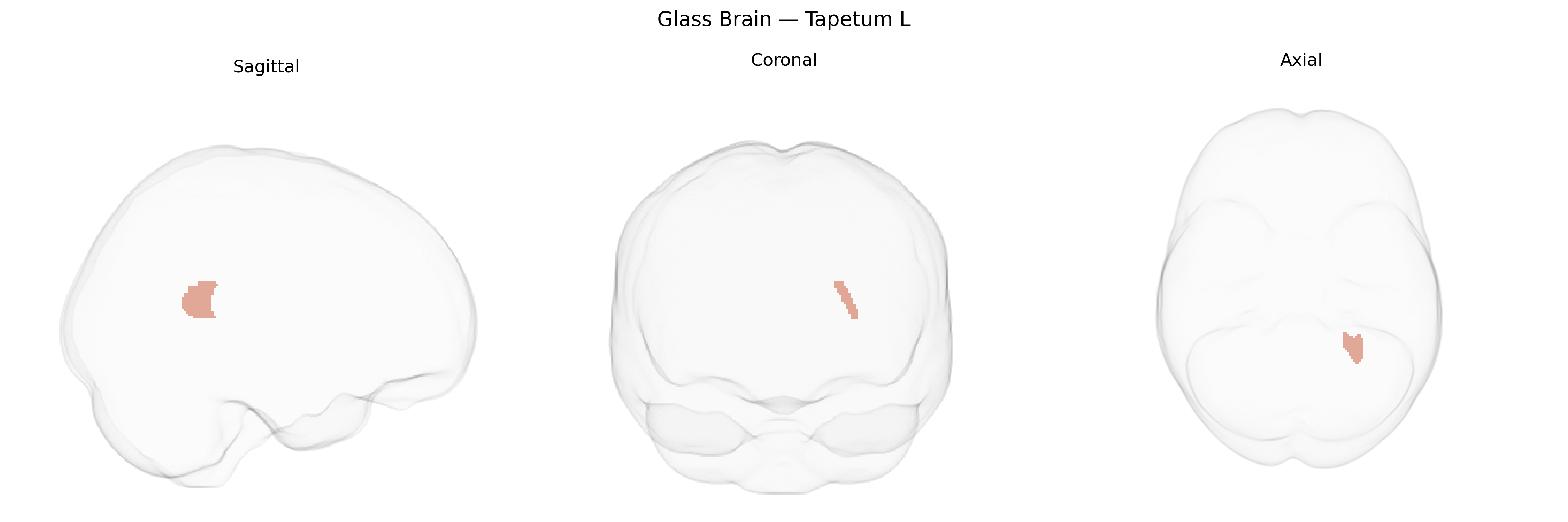 Triplanar Ghost Brain