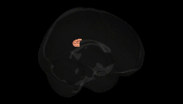Full Brain Black
