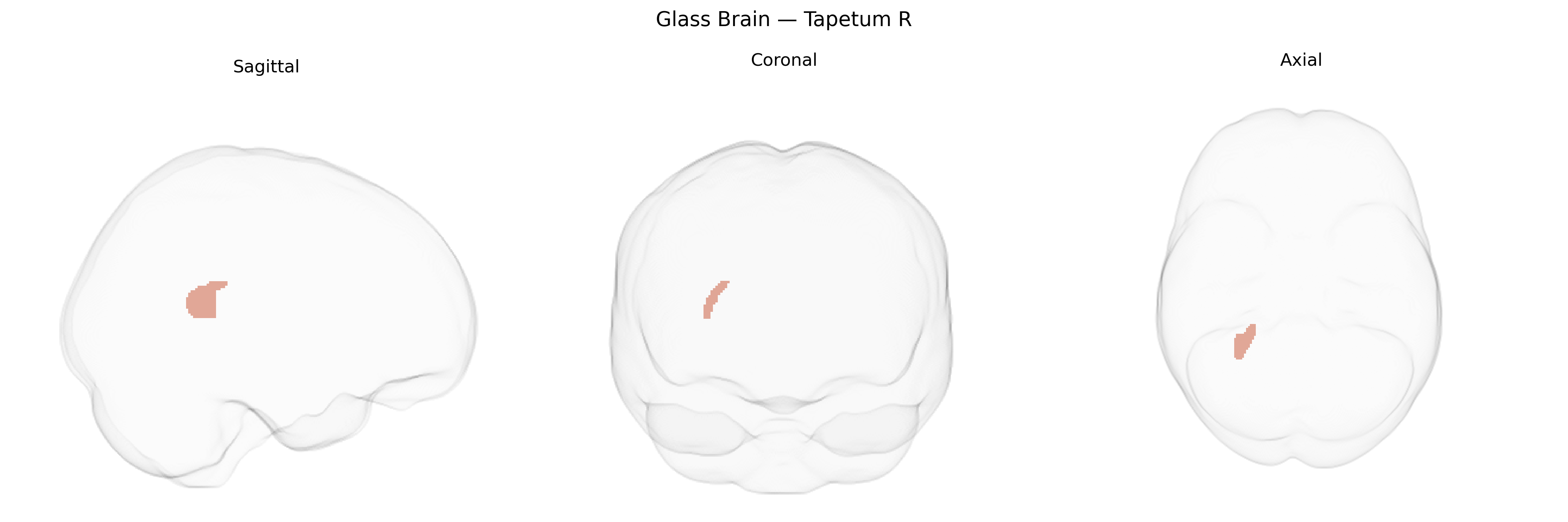 Triplanar Ghost Brain
