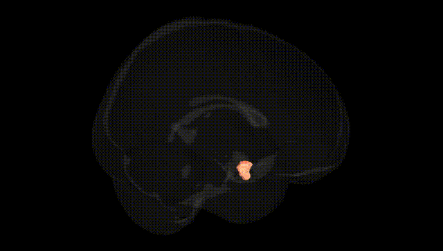 Full Brain Black