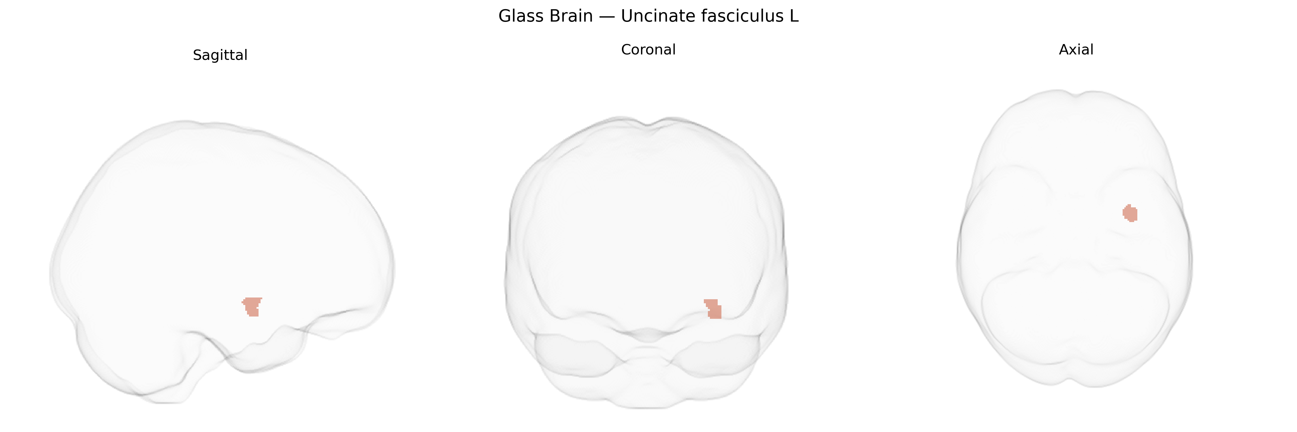 Triplanar Ghost Brain