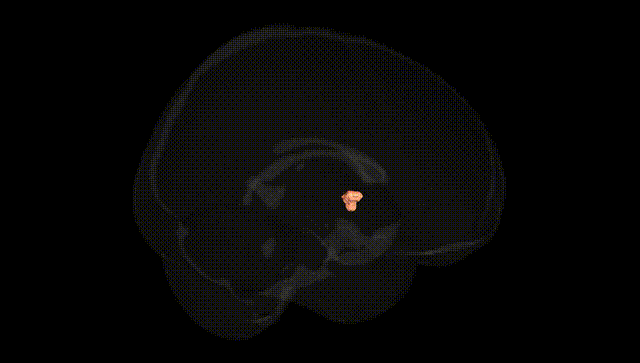 Full Brain Black