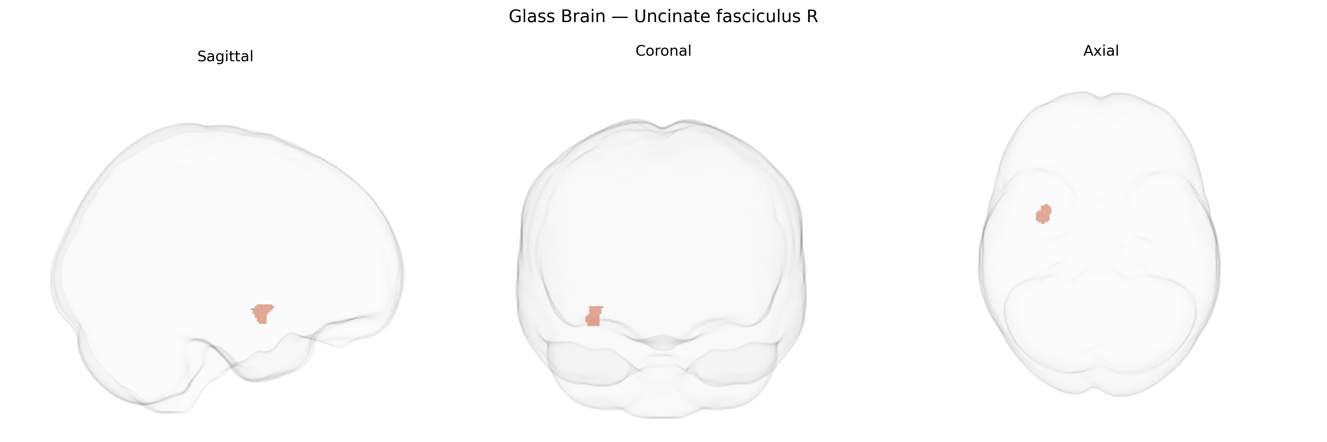 Triplanar Ghost Brain