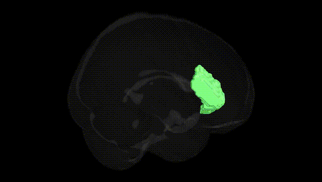Full Brain Black