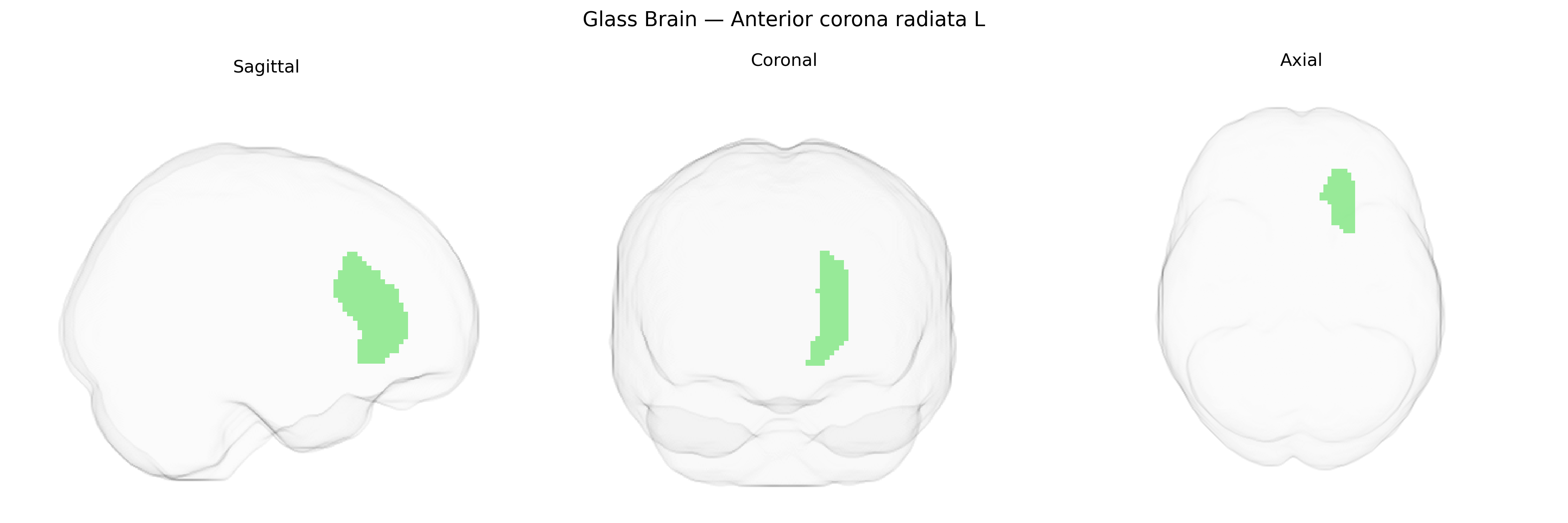 Triplanar Ghost Brain