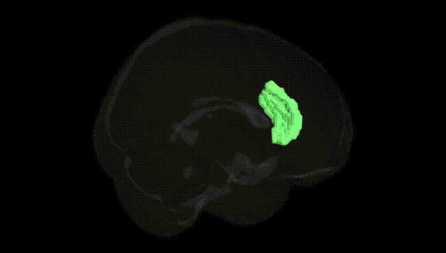 Full Brain Black