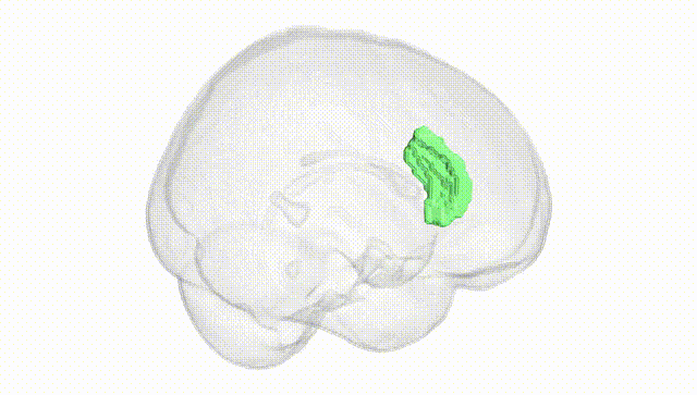 Full Brain White
