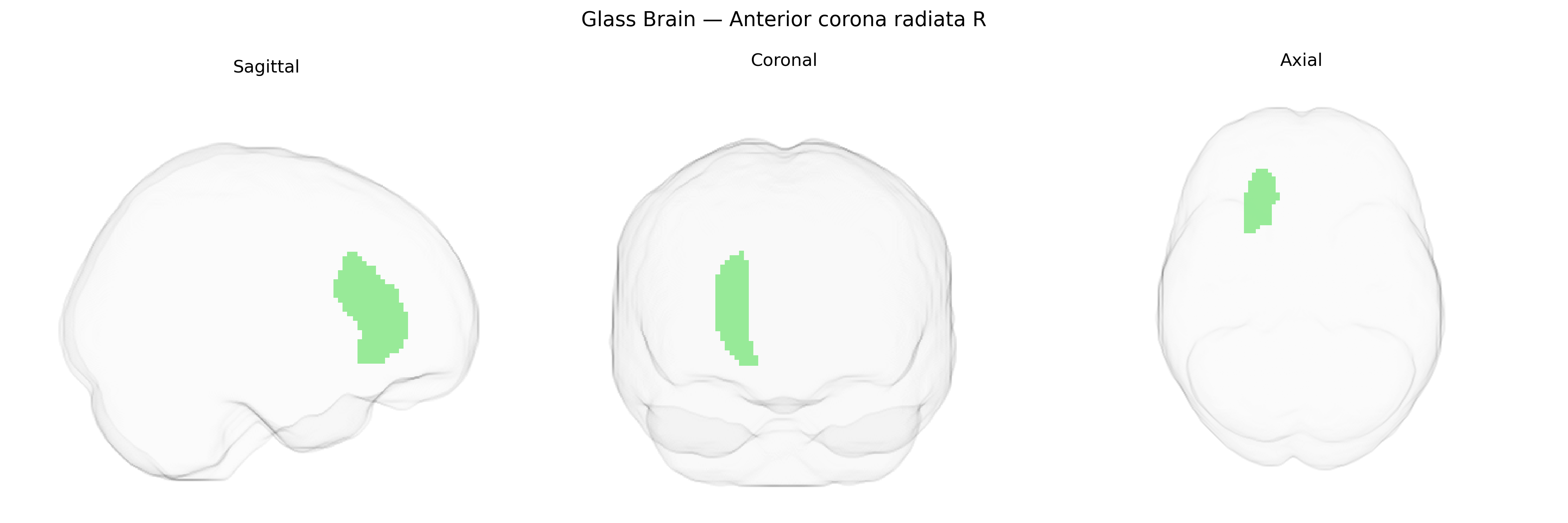Triplanar Ghost Brain