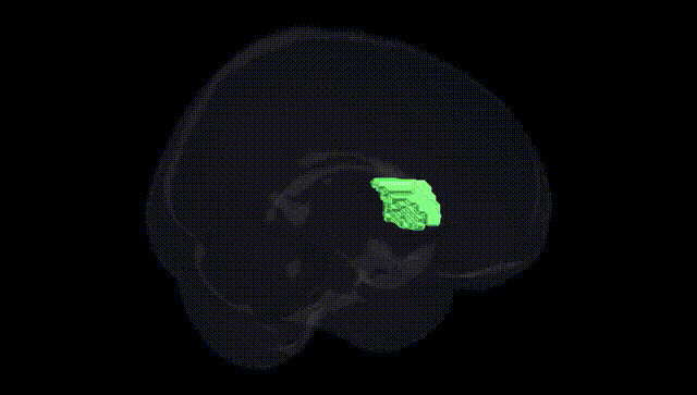 Full Brain Black