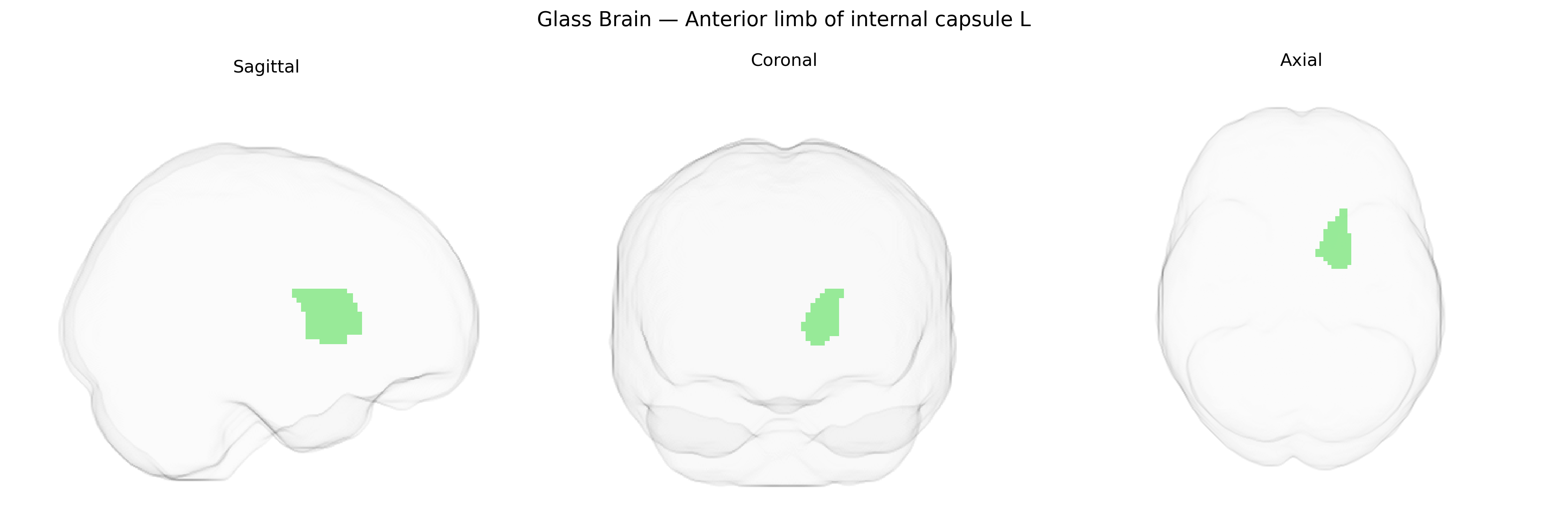 Triplanar Ghost Brain