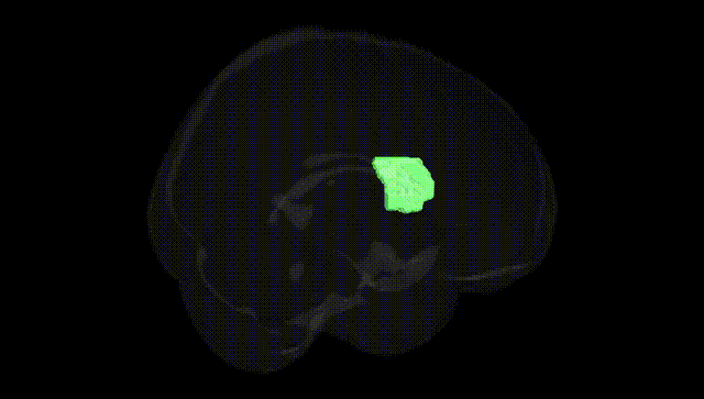 Full Brain Black
