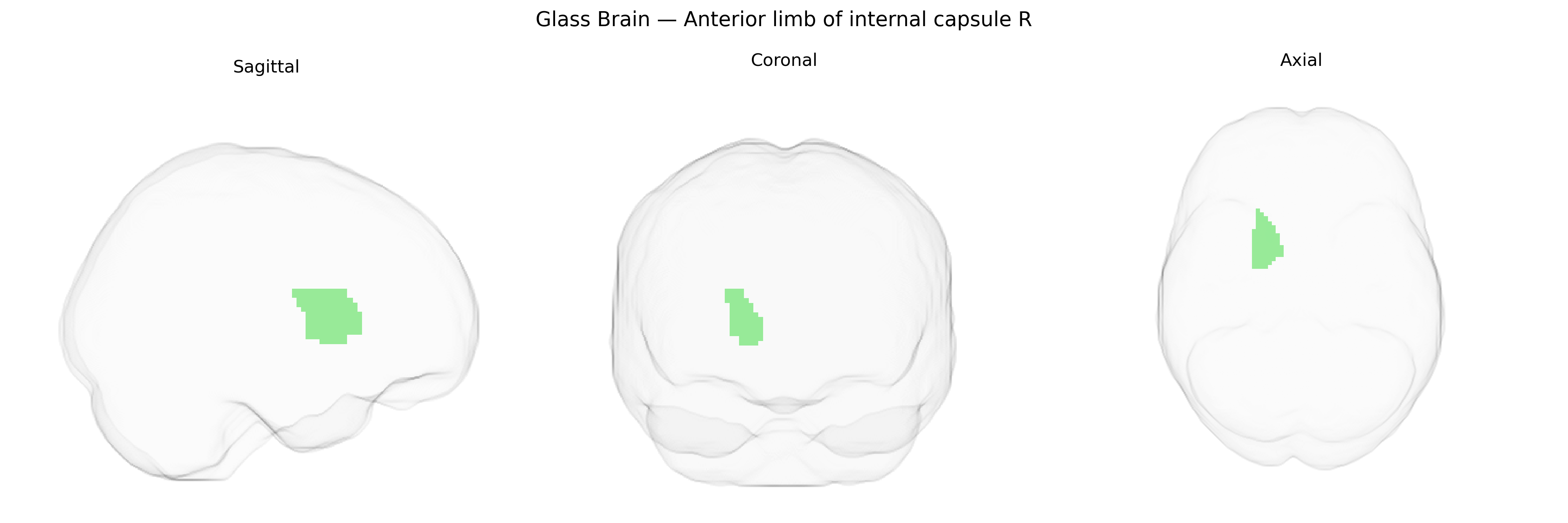 Triplanar Ghost Brain