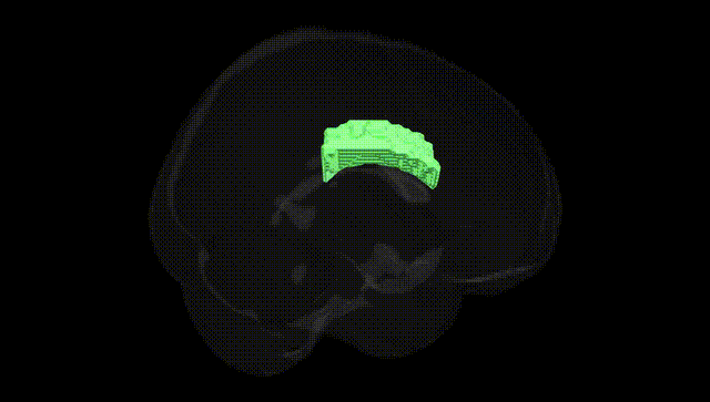 Full Brain Black