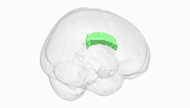 Full Brain White
