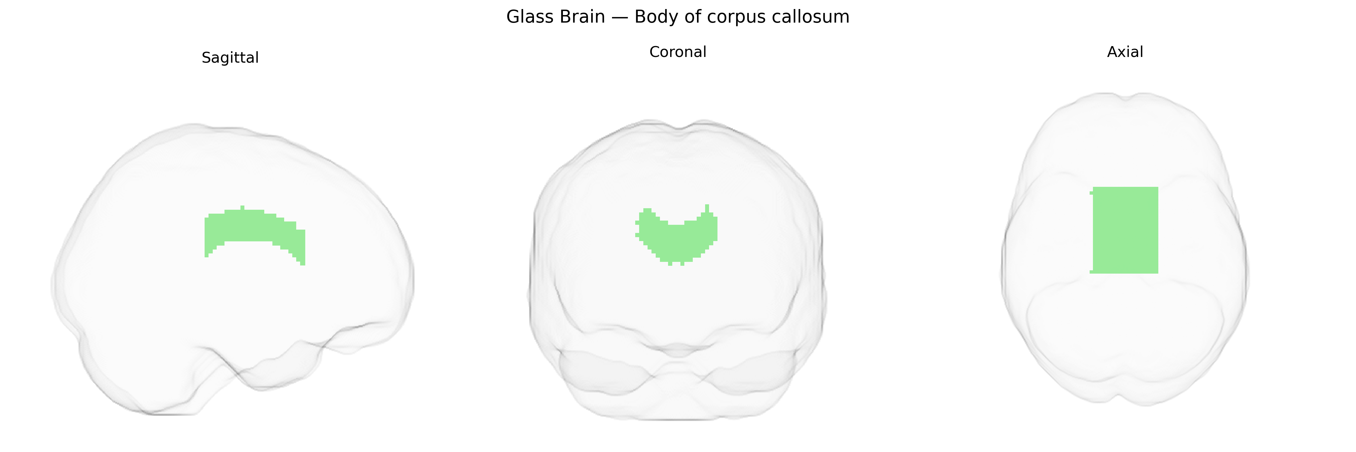 Triplanar Ghost Brain