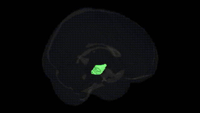 Full Brain Black