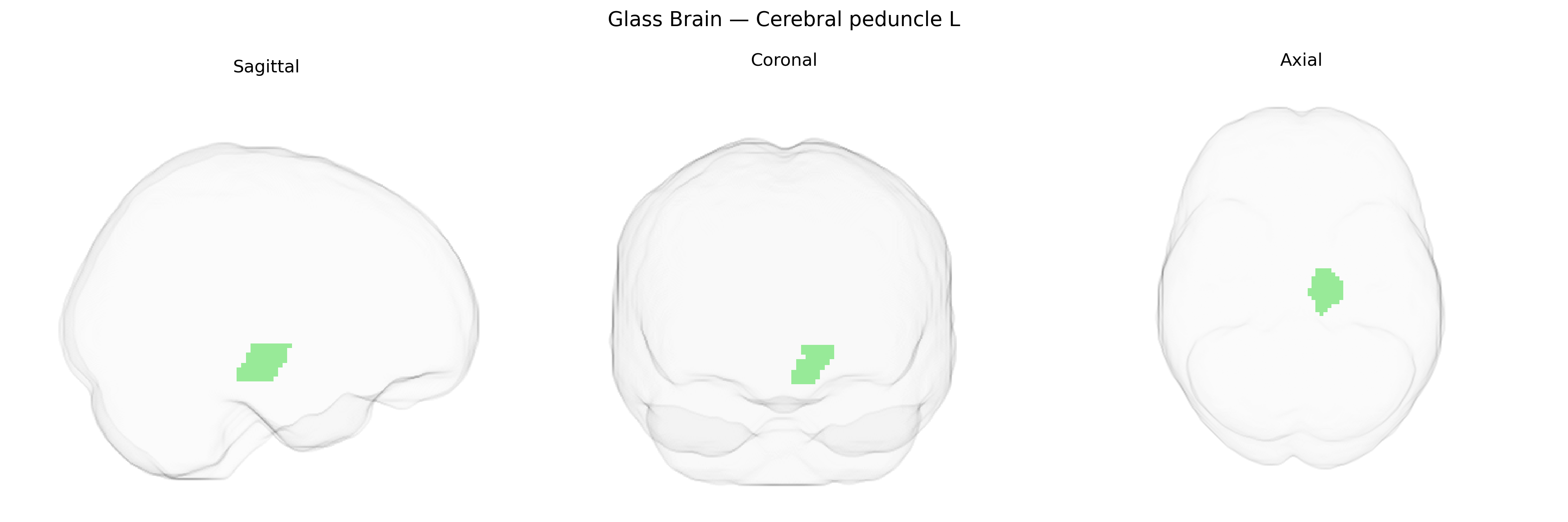 Triplanar Ghost Brain