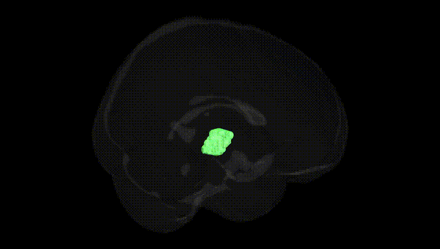 Full Brain Black