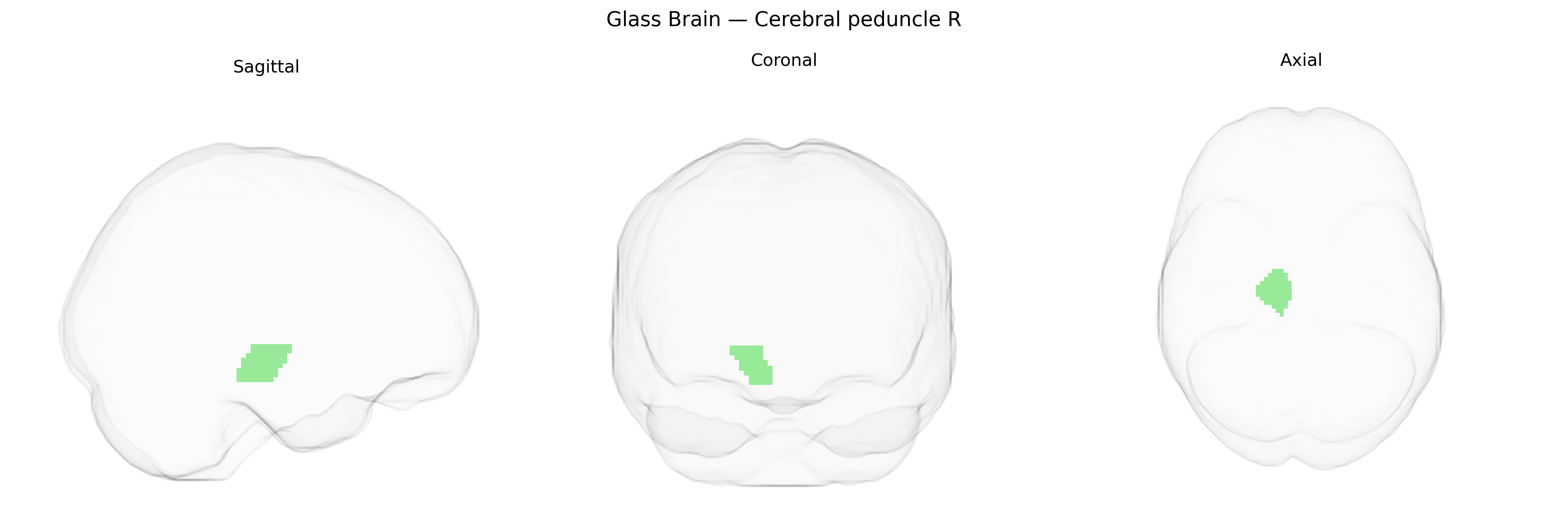 Triplanar Ghost Brain