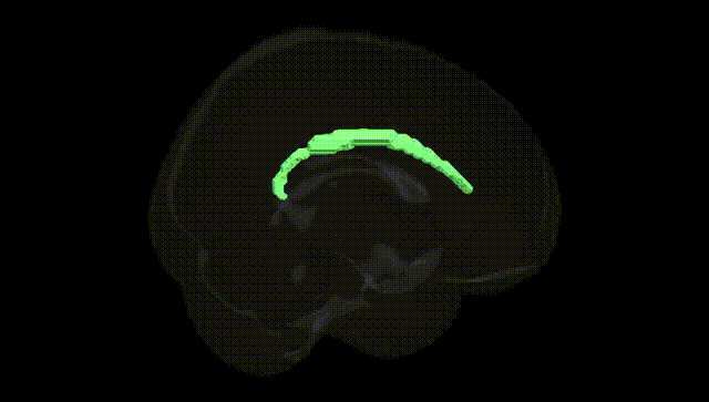 Full Brain Black