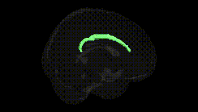 Full Brain Black
