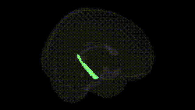 Full Brain Black