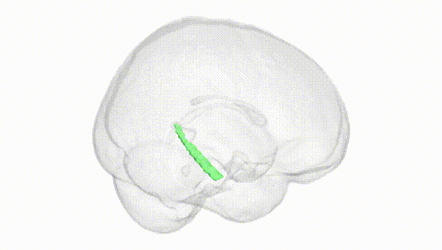 Full Brain White