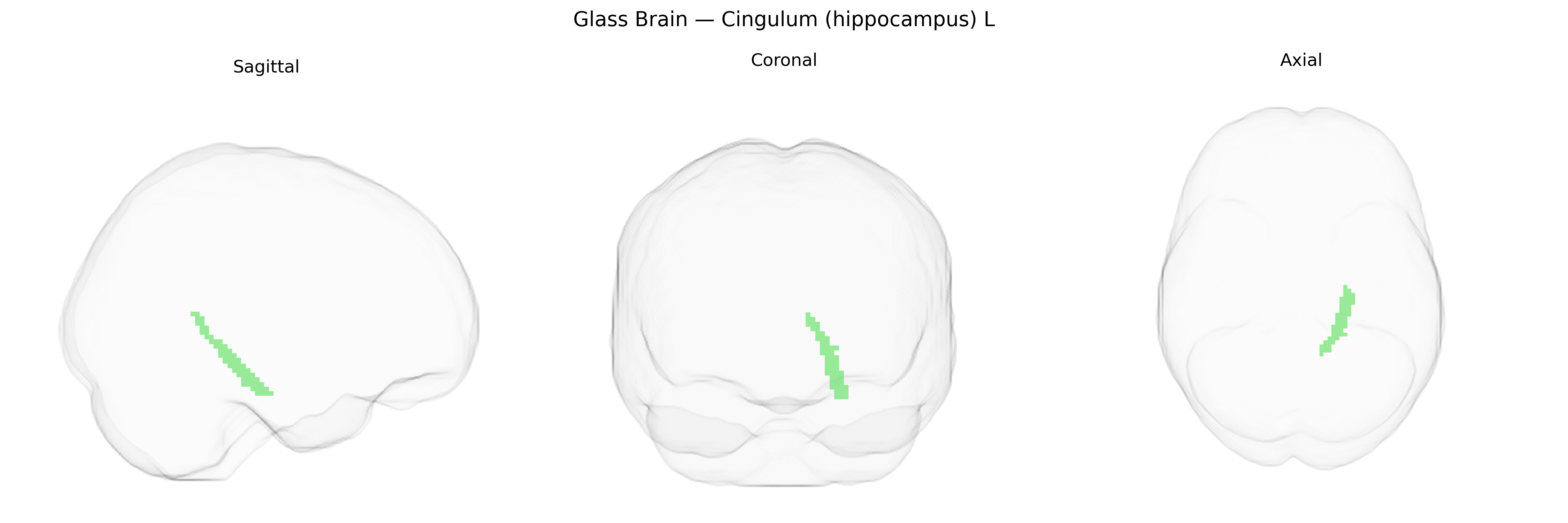 Triplanar Ghost Brain
