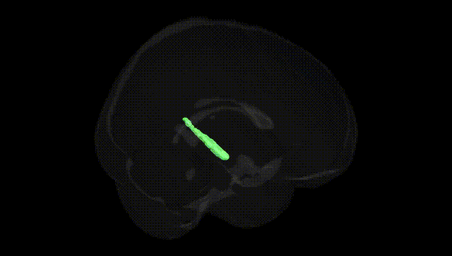 Full Brain Black