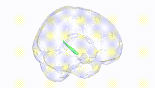 Full Brain White