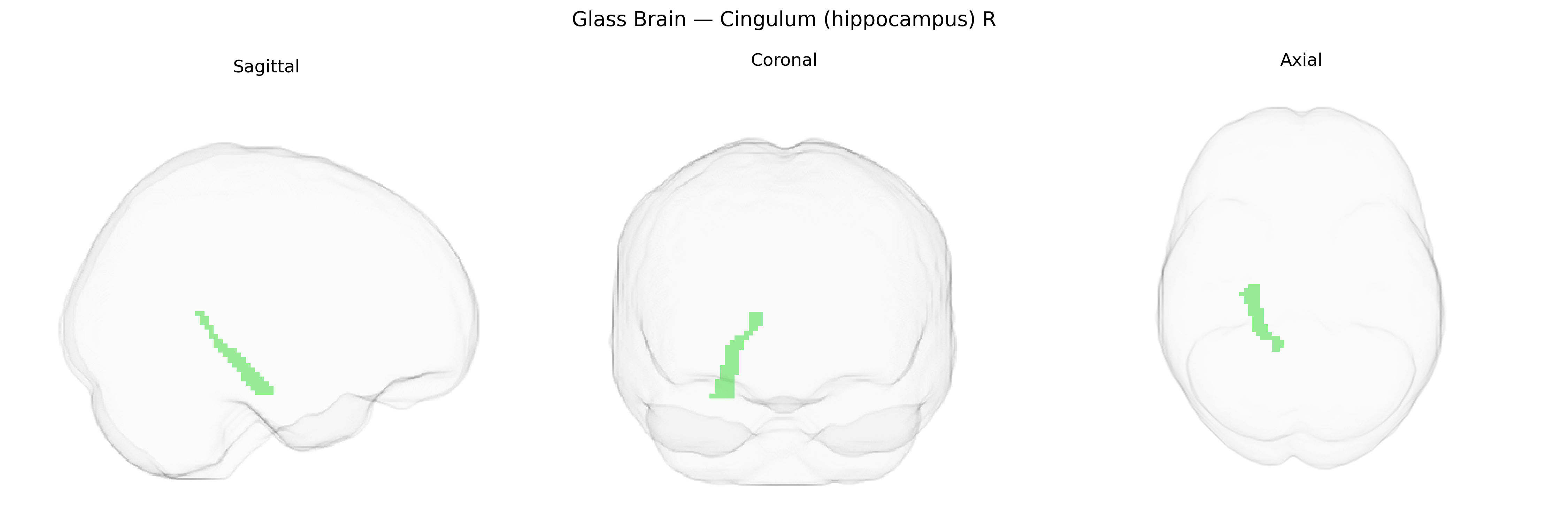 Triplanar Ghost Brain