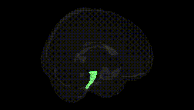 Full Brain Black