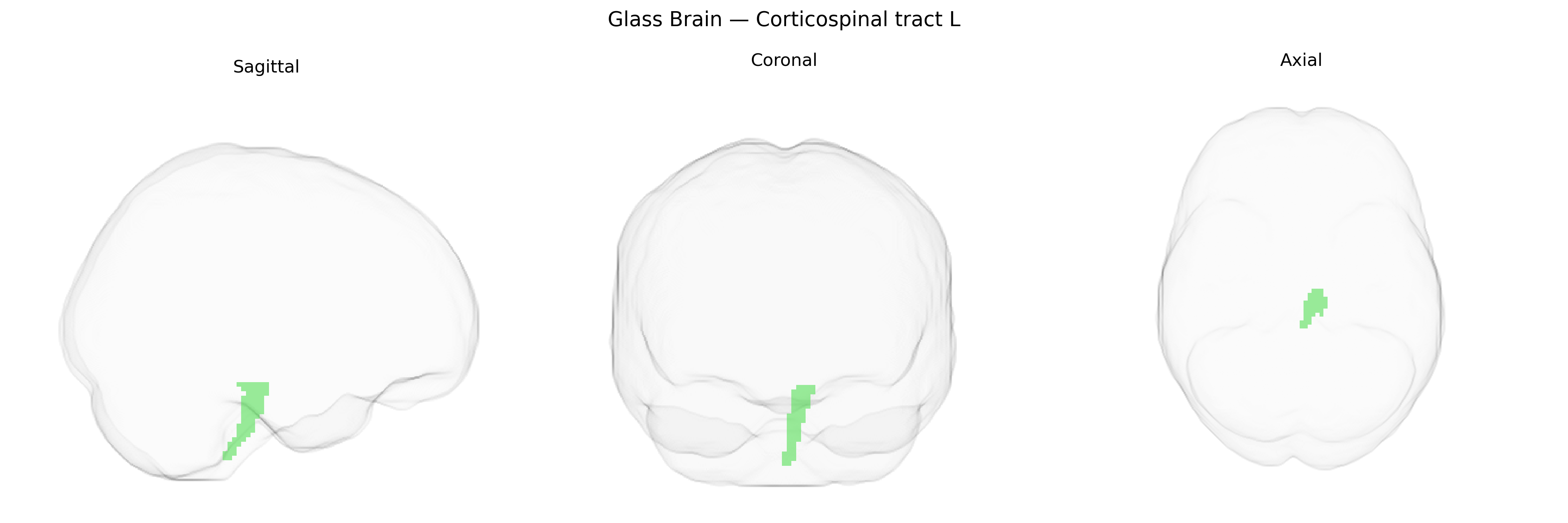 Triplanar Ghost Brain
