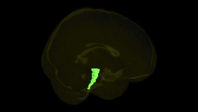 Full Brain Black